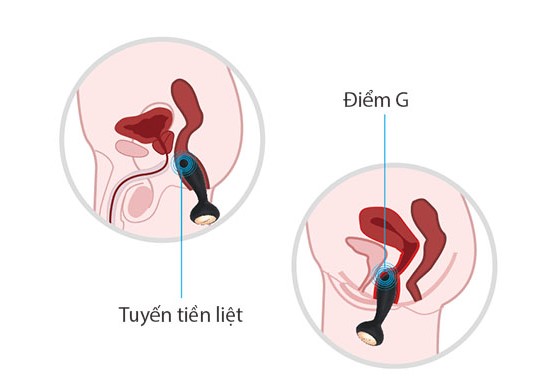 Máy Rung Kích Thích Hậu Môn & Điểm G Svakom Judy - DC90S