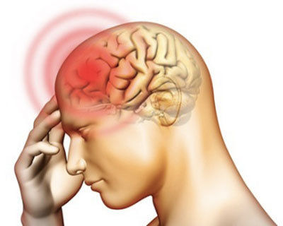 Bệnh viêm não mô cầu có nguy cơ lan rộng trong cộng đồng