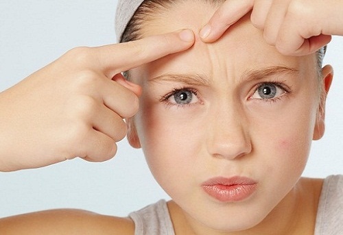 Những sai lầm gây chết người khi nặn mụn Những sai lầm gây chết người khi nặn mụn