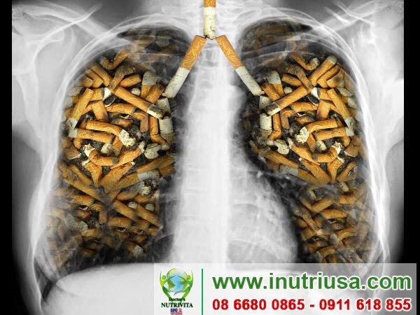 Hút thuốc lá tăng nguy cơ mắc bệnh ung thư phổi cao, căn bệnh chiếm tỉ lệ cao nhất trong số các bệnh ung thư