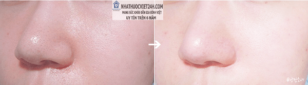 thuốc trắng da my j pink