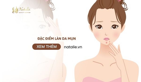 đặc điểm da mụn