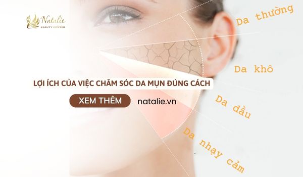 lợi ích chăm da mụn đúng cách