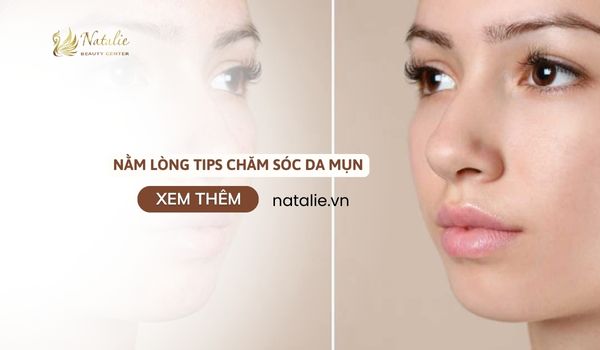 nằm lòng tips chăm sóc da mụn