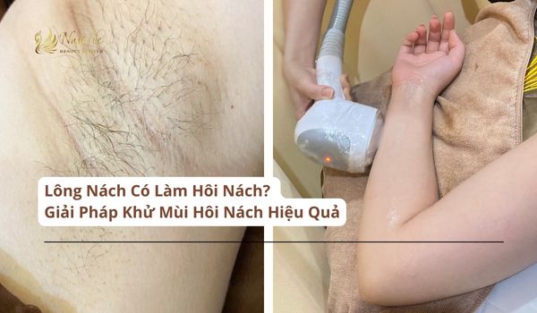 lông nách có làm hôi nách na