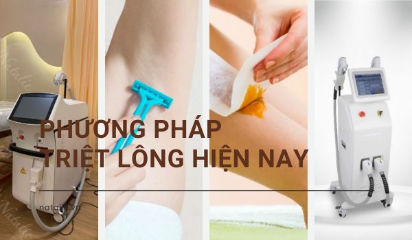 phương pháp triệt lông hiện nay