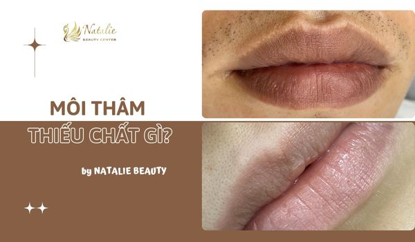 môi thâm thiếu chất gì