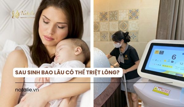 sau sinh bao lâu thì triệt lông