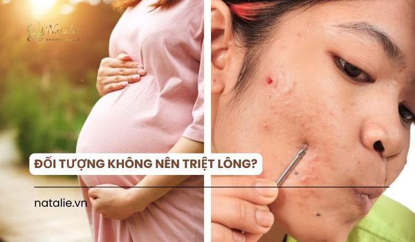 đối tượng không nên triệt