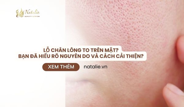 lỗ chân lông to trên mặt