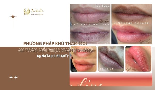 phương pháp khử thâm glowlips