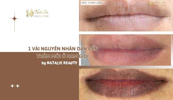 nguyên nhân thâm môi nam
