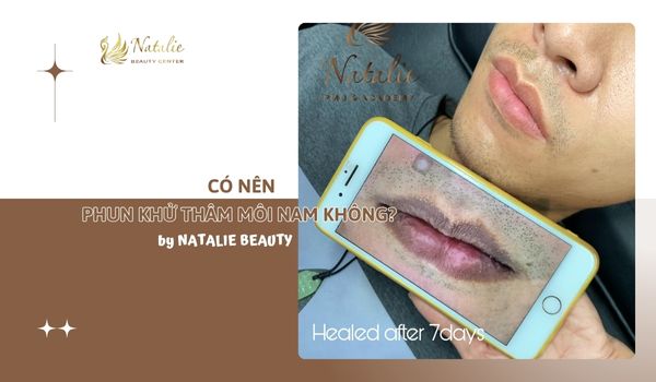 có nên khử thâm môi nam