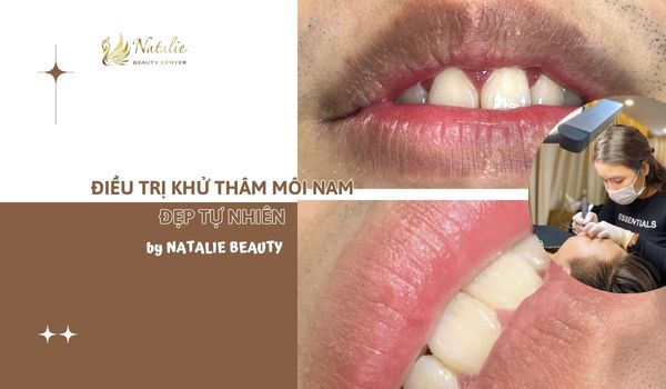 điều trị khử thâm môi nam tự nhiên