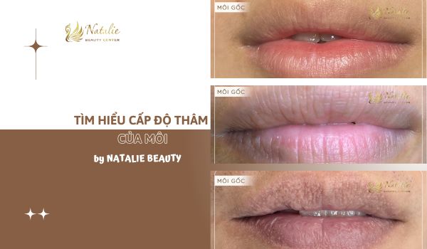 cấp độ môi thâm