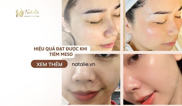 hiệu quả sau tiêm