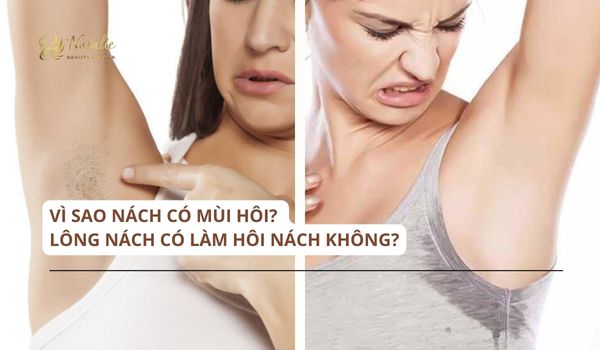 vì sao nách mùi hôi