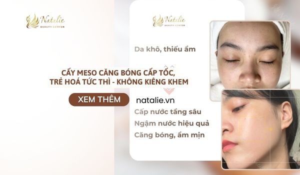 cấy meso căng bóng tức thì