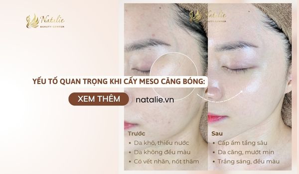 yếu tố quan trọng cấy meso căng bóng