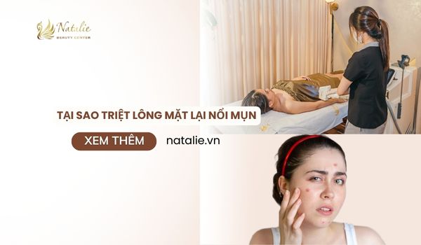 tại sao triệt lông mặt lại nổi mụn giải đáp