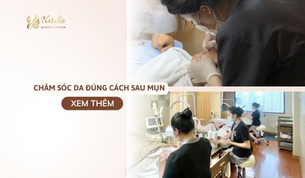 chăm sóc sau mụn