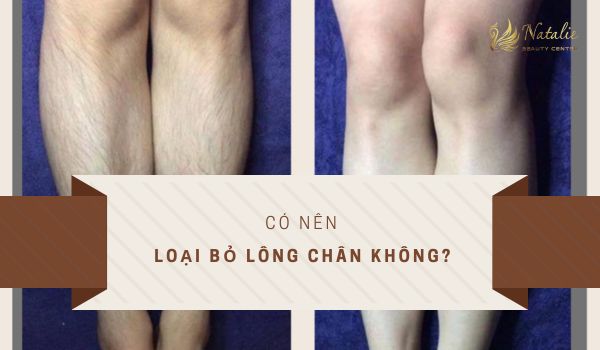 có nên loại bỏ lông chân không