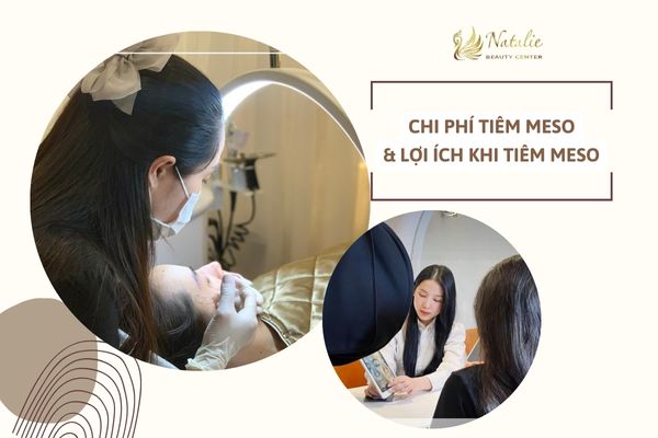 bật mí chi phí tiêm meso