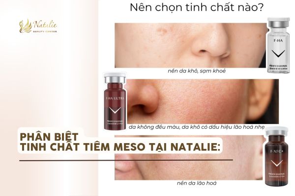 tinh chat meso phan biet