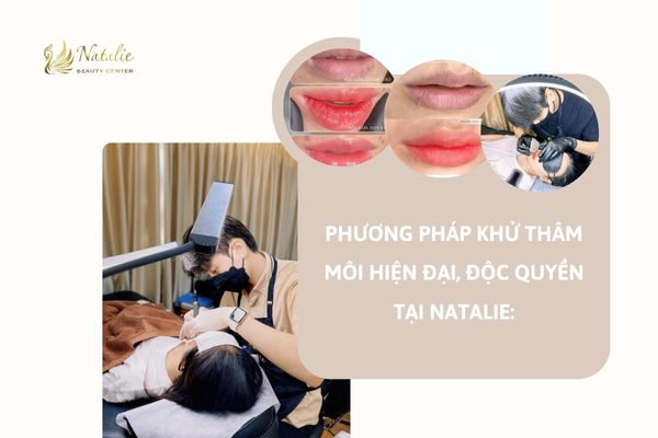 phương pháp độc quyền na