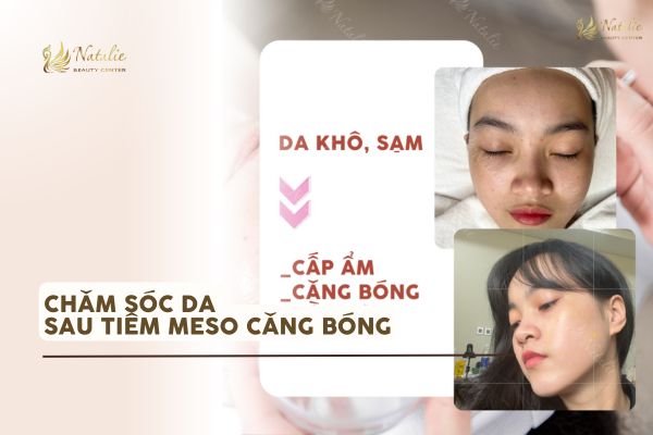 chăm da sau tiêm meso