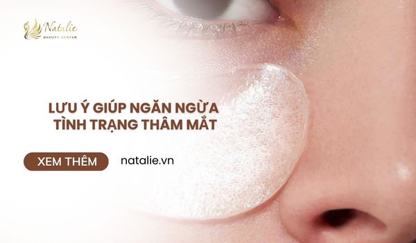 lưu ý giúp ngăn ngừa thâm mắt