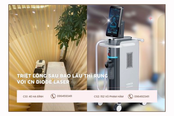 triệt lông với diode laser bao lâu rụng
