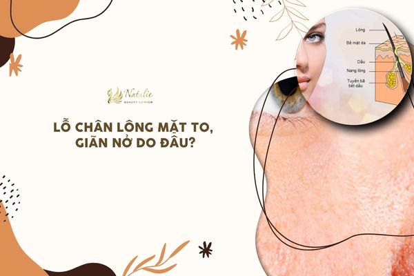 nguyên chân do đâu lỗ chân lông giãn nở