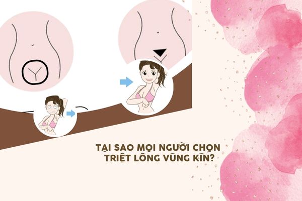tại sao triệt vùng kín