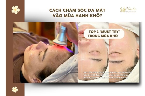 top 3 dịch vụ chăm sóc da mặt