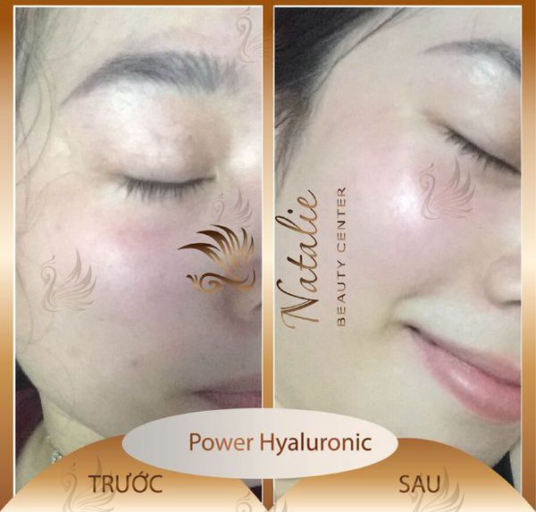 spa-cang-bong-da-tot