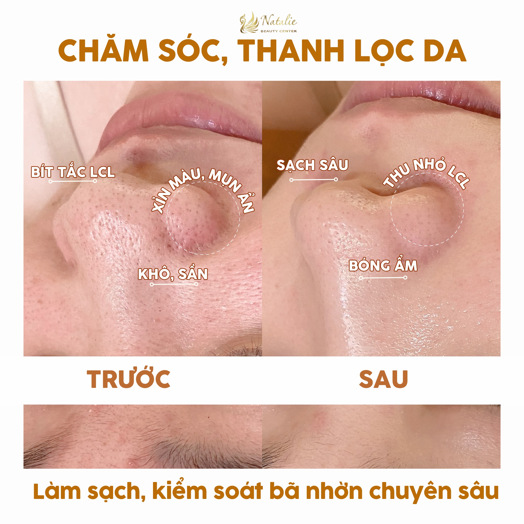 chăm da thanh hai