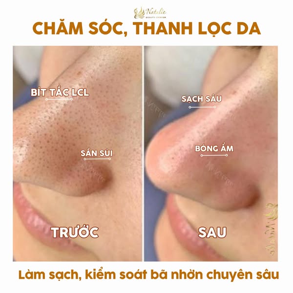 chăm da thanh một