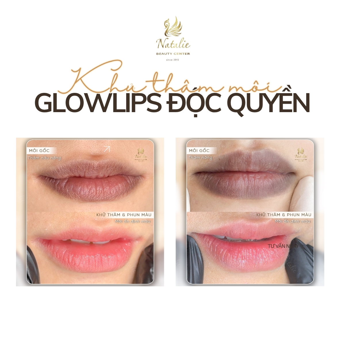glowlips độc quyền khử thâm