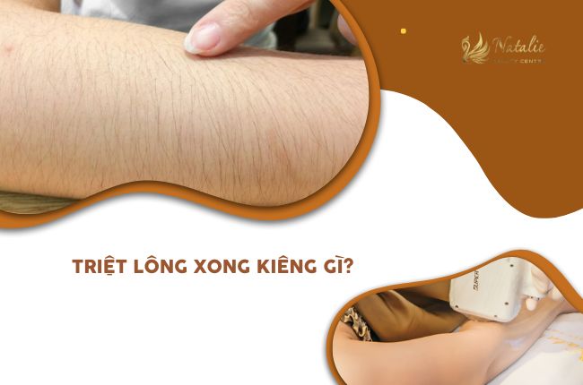 triệt lông kiêng những gì