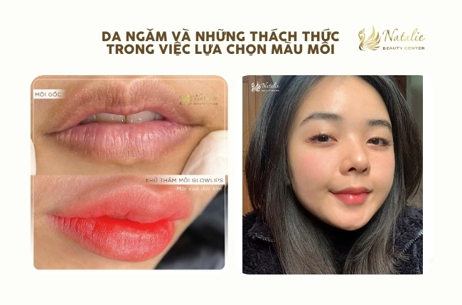 da ngăm và thách thức