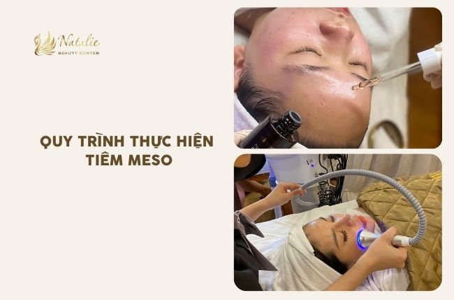 quy trình tiêm meso ne