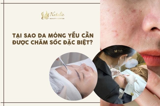 chăm sóc đặc biệt da mỏng yếu