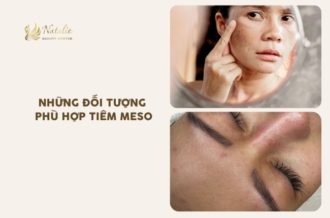 đối tượng nên meso tết