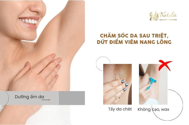 chăm sóc viêm nang lông