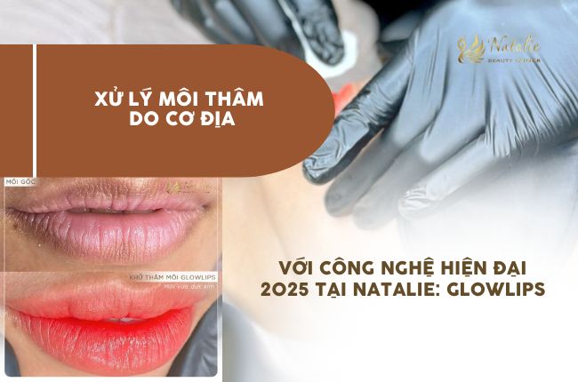 xử lý môi thâm cơ địa