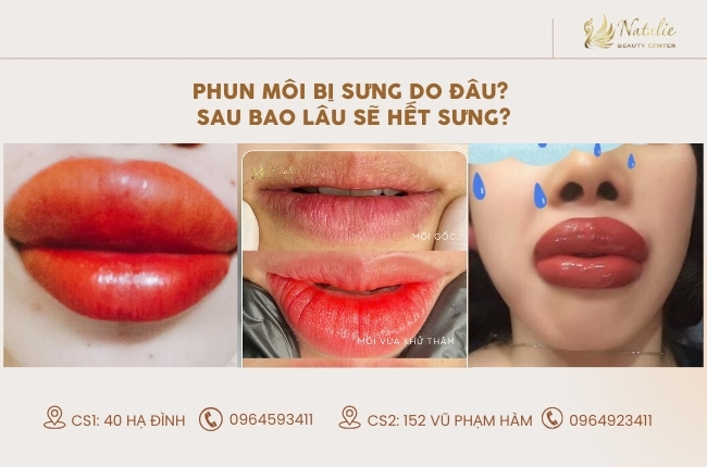 nguyên do bị sưng sau phun