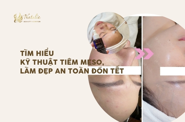 hiểu rõ về kỹ thuật tiêm meso