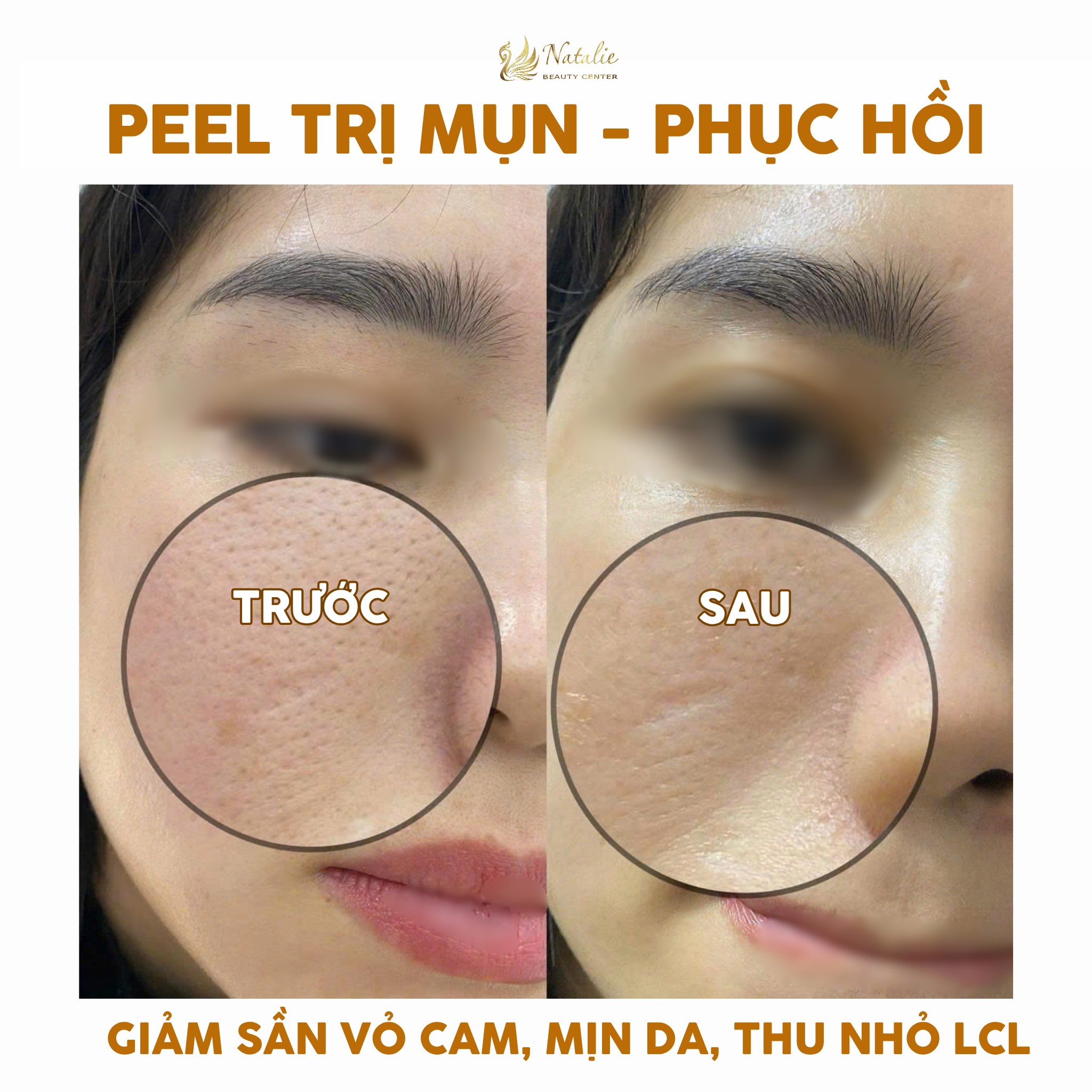 peel tri mun hai