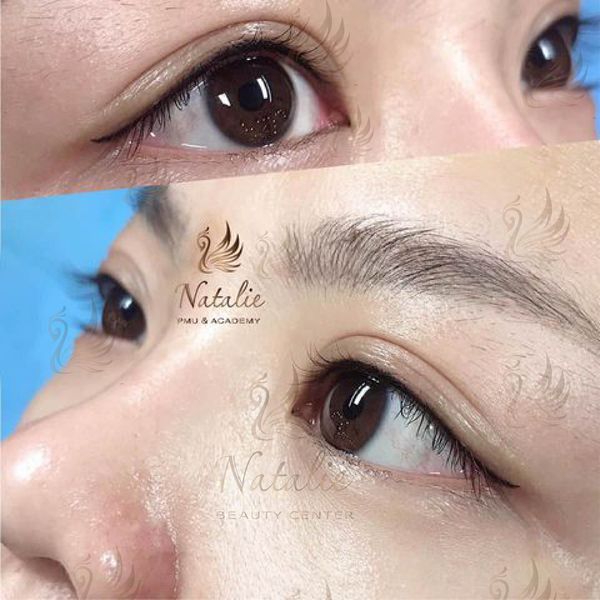 Phun-mi-mo-trong-tai-Natalie